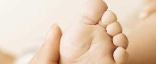 Qué es el pie plano y hasta que edad es normal