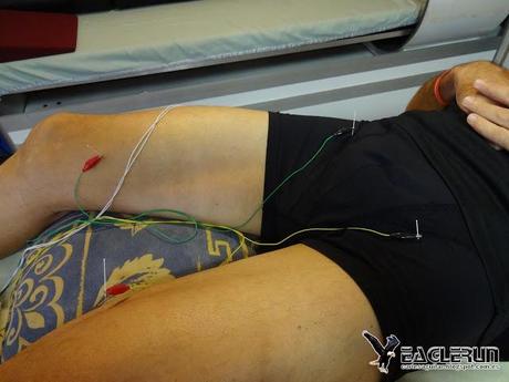 Sesión de Acupuntura Neurofuncional  a cargo de Toni Gordo. Una terapia que  llega a España a través de la Universidad de McMaster en Hamilton (Canadá). Una técnica especialmente eficaz en medicina deportiva.