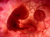 Feto polémica ética