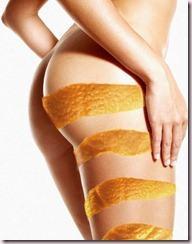 causas de la celulitis thumb Reduce la celulitis con remedios naturales