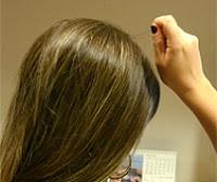 Tricotilomanía o manía de tirarse de los cabellos