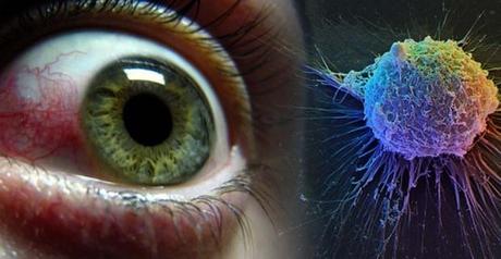 HUESOS EN LOS PARPADOS