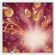 Infección por Candida Albicans