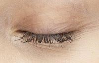 Arrugas, bolsas y ojeras