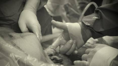 bebe agarra la mano de médico al nacer