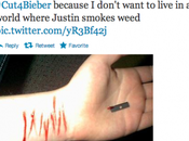 Justin Bieber autolesiona para ídolo deje drogas