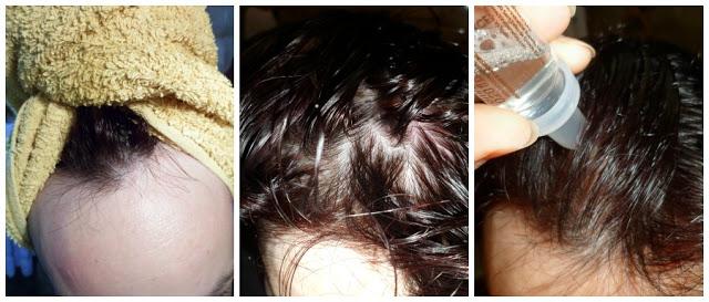 Kinactif Force, contra la caída del cabello