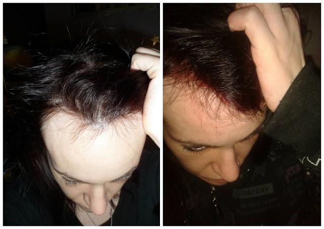 Kinactif Force, contra la caída del cabello