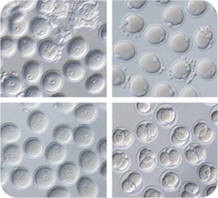 Hitos científicos del 2012 según Science Hitos científicos del 2012 según Science