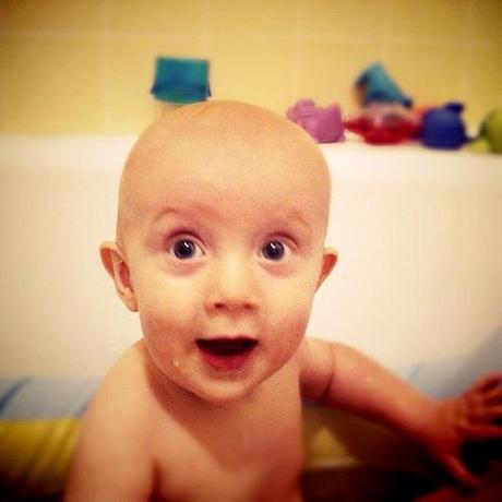 bebe-fimosis bebe-fimosis