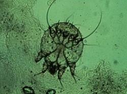 Remedios caseros para la escabiosis