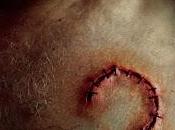 Cell Count Blood primer teaser poster