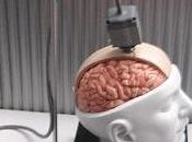 Implantan cerebro primera memoria artificial