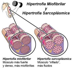 hipertrofia
