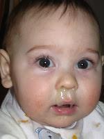 ¿Los lácteos aumentan los mocos? No, es in mito