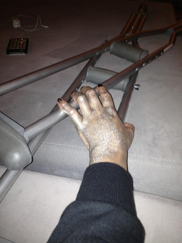 ¡Demi Lovato sufre accidente!