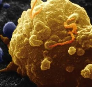 melanoma_PRinc_BA2189