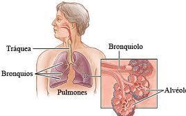Que es la bronquitis aguda, causas, síntomas y tratamiento