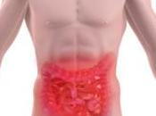 Dieta para gastritis úlceras