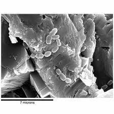 Novedoso Biomaterial capas de Regenerar Fibras Nerviosas