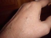 Matiderm y Heliocare proteccion solar con color