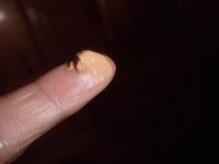 Matiderm y Heliocare proteccion solar con color