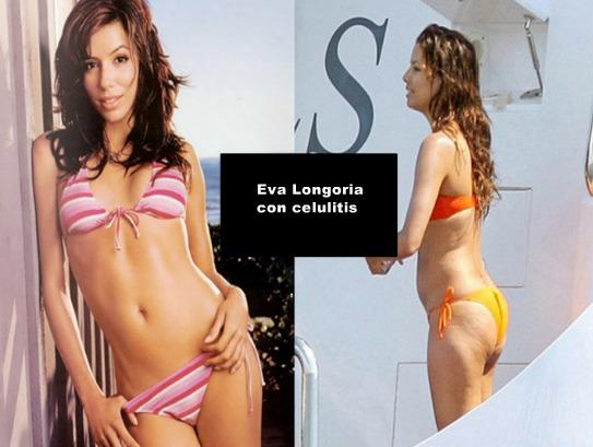 LAS CELULITIS DE 20 FAMOSAS - IMÁGENES