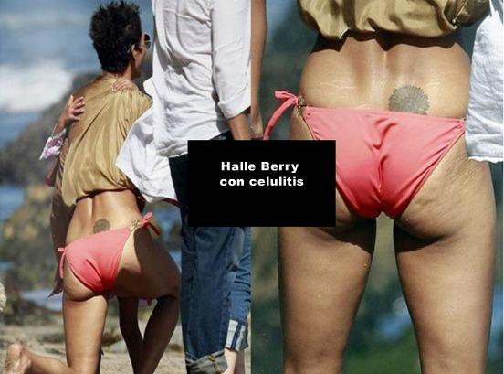 LAS CELULITIS DE 20 FAMOSAS - IMÁGENES