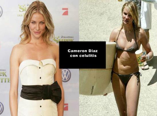 LAS CELULITIS DE 20 FAMOSAS - IMÁGENES