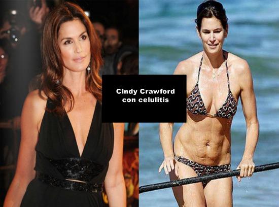 LAS CELULITIS DE 20 FAMOSAS - IMÁGENES