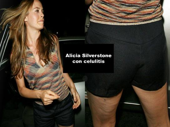 LAS CELULITIS DE 20 FAMOSAS - IMÁGENES