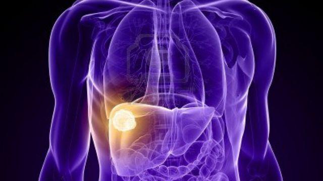 Llaman a la innovacion de politicas contra la Hepatitis C.