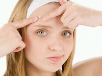 ISOTRETINOINA (ROACUTAN) A DOSIS BAJA, ¡FUNCIONA!