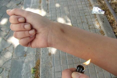 ¿CUAL ES LA RAZON PARA AUTOLESIONARSE?