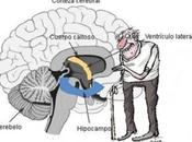 Hallan molécula implicada deterioro cognitivo edad