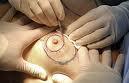 cirujanos plásticos tienen papel clave grandes avances quirúrgicos mama