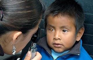 Cuidando los ojos de los niños, primera parte