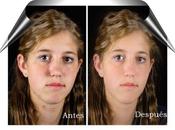 ¿Cómo Retocar Rostro unos Simples Pasos?