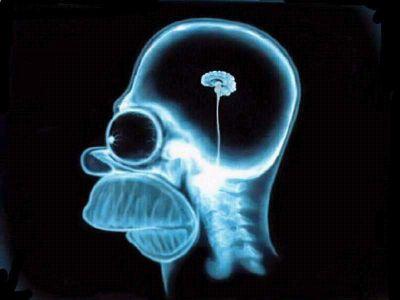 Los tontos del pueblo