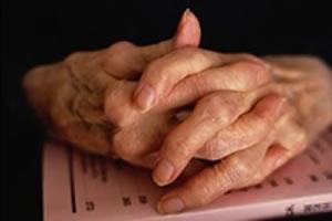 artritis reumatoidea