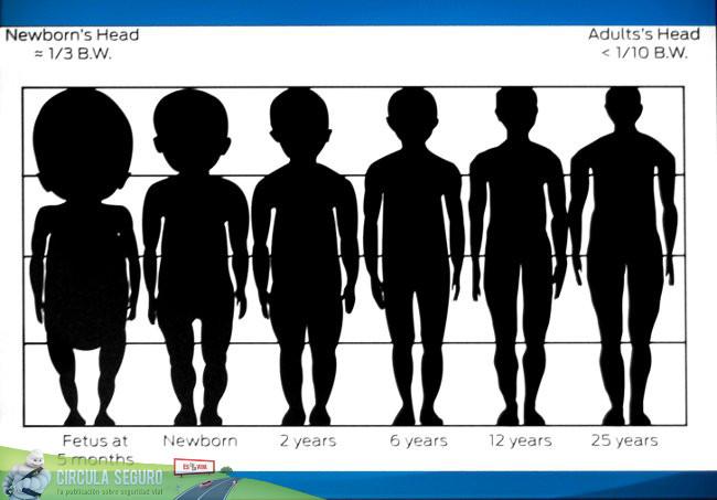 Desproporción entre cabeza y cuerpo de un niño