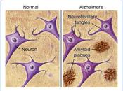 Cultivos celulares para estudio Alzheimer