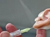 Crean orejas artificiales para niños malformaciones