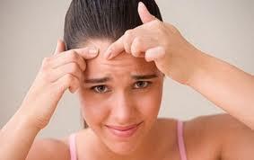 Cinco cremas caseras contra el acné