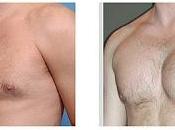 Cirugía estética para hombres