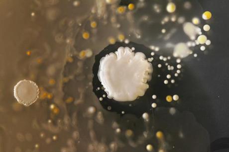 smartphone_bacteria_5