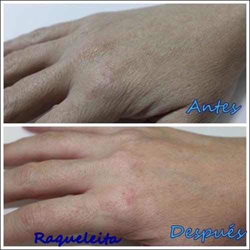 Mis manos mas jóvenes con Facialderm