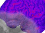 alzhéimer precio pagar nuestras capacidades cognitivas?