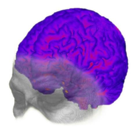 La evolución cerebral como origen de la enfermedad de Alzheimer (Foto: CENIEH)