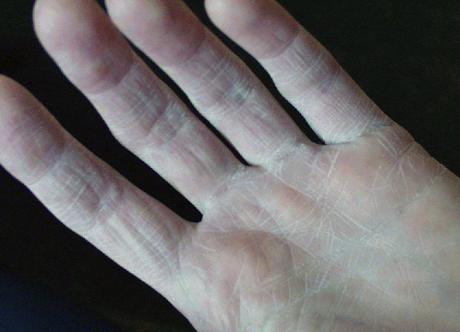 Obsesion por lavarse las manos